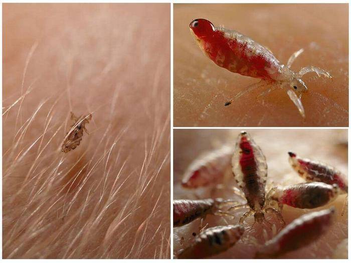Вошь (90 фото) - описание насекомого, как избавится, где обитает, чем питается